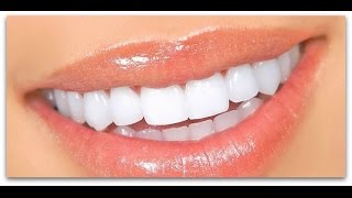 How To Dramatically Whiten Teeth In 5 Minutes NATURALLY