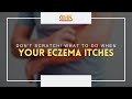Don't Scratch! What to Do When Your Eczema Itches (PART 1) | Usapang Pangkalusugan