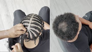 How to braid over hair loss in crown area #shorthairbraids  | My Grip Game