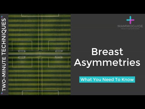 Two Minute Techniques - Breast Asymmetries