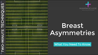 Two Minute Techniques - Breast Asymmetries