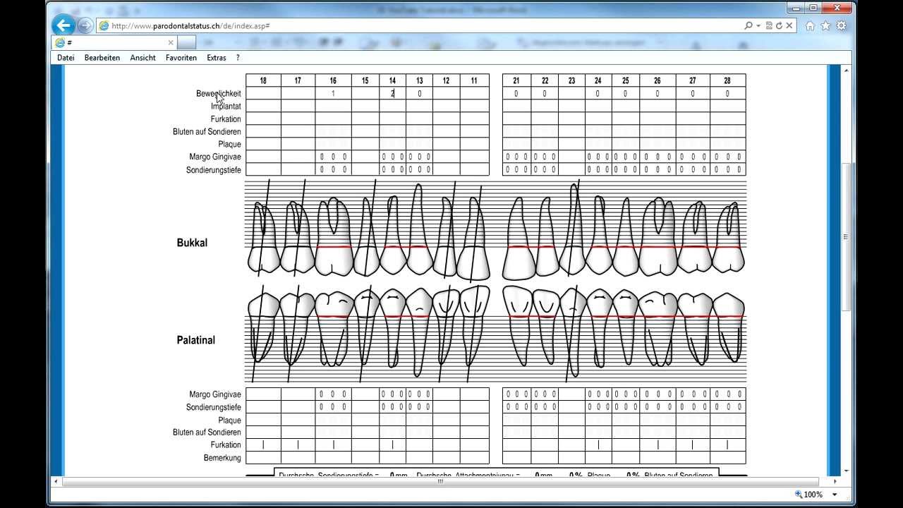Tutorial Parodontalstatus - YouTube