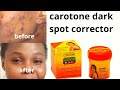 CAROTONE: BLACK SPOT CORRECTOR/ BEFORE AND AFTER  REVIEW.