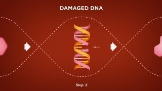 Beyond The Shock - Chapter 3 - Breast Cancer - What is Cancer?