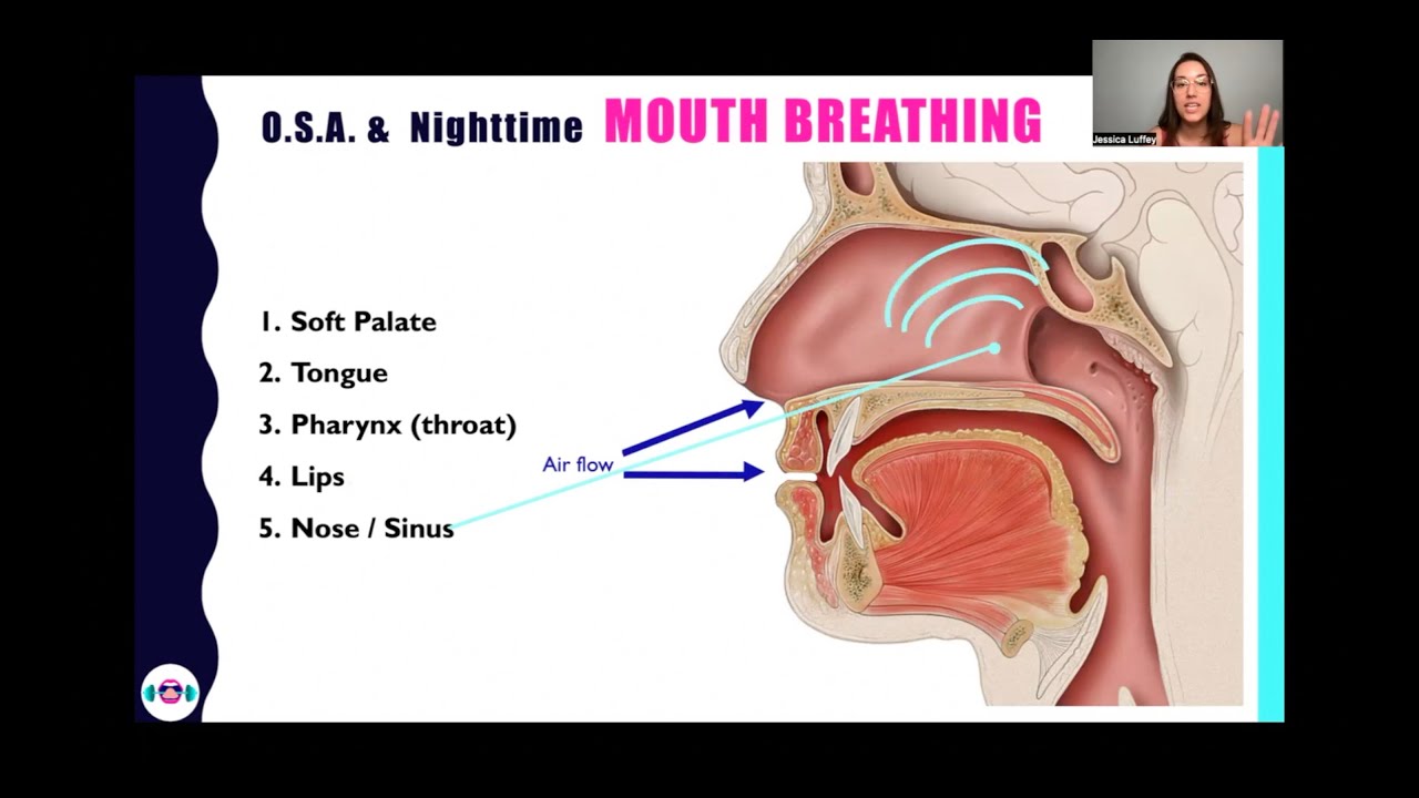 How Tongue Ties Cause Snoring & Sleep Apnea, CPAP Obstructive Sleep Apnea and Tongue Tie are related