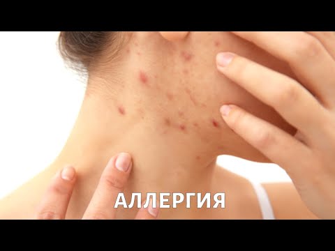 Video: Кайсы мышыктын тукуму аллергия алып келбейт?