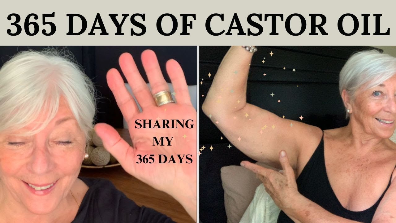 365 DAYS OF CASTOR OIL , SHARING MY 365 DAYS
