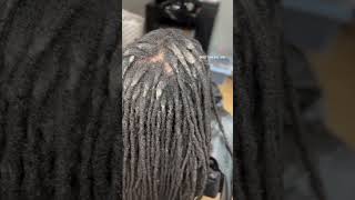 Buildup Removal😱 ✨ FULL VIDEO SOON!✨ #dandruff #dandruffscratching #locs #locstyles #dreads