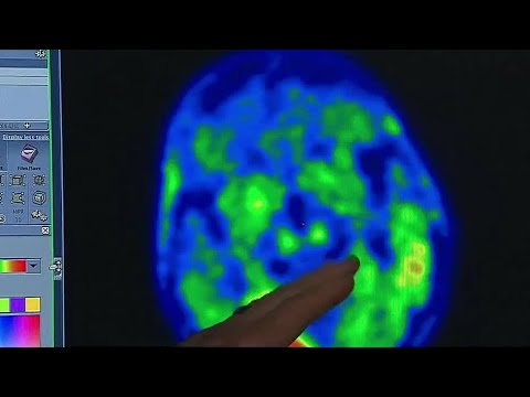 Study sheds new