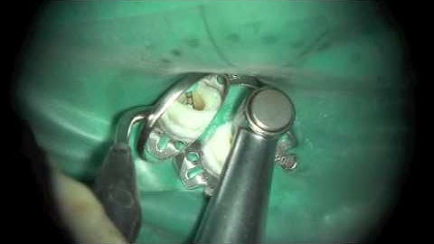 Take five! - Dr. Tomas Lang