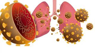 How does Coronavirus affect our lungs