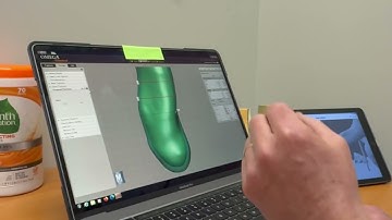 Real Life Prosthetics: Custom Liners Part 2 Customizing