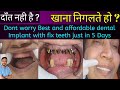 डेंटल इम्प्लांट एवं फिक्स दाँत सिर्फ 5 दिनों में 😊👍! Dental implant treatment Full live video