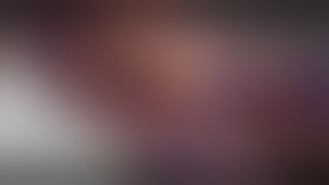 Orthoplastic Approach to Tibial Nerve Exposure of the Distal Lower Extremity