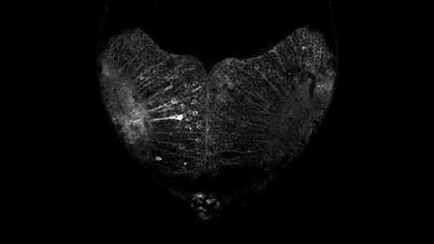 Real-Time Visualization of Neuronal Activity