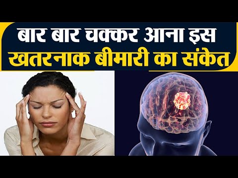 वीडियो: कैसे पता करें कि कब चक्कर आना एक गंभीर लक्षण है: 13 कदम