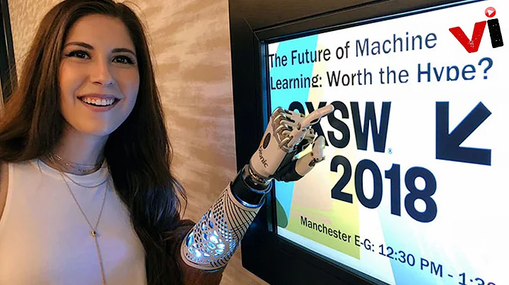 Amputee Asks People To Unplug Phone So She Could Charge Arm, Gets Not The Response She Expects