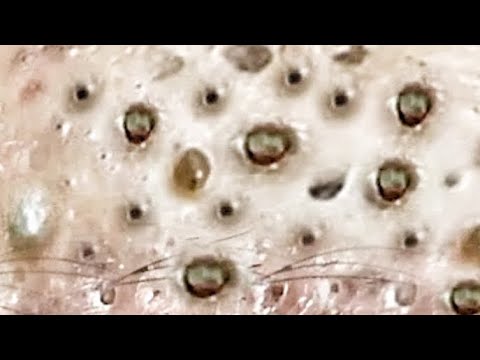 Best Pops, Volume 2! Click the Subcription Bell!