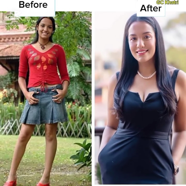 Nepali Actress Before and After.. #priyankakarki #aachalsharma #gckhatri #shorts #nepal #trending
