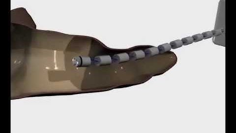 Robotic Endoscope Concept