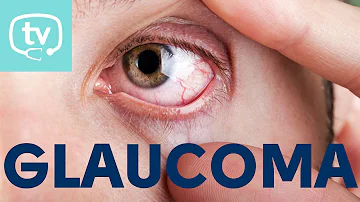 ¿Qué cifra se considera alta para el glaucoma?