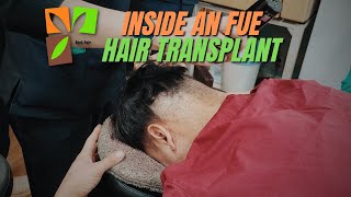 Inside an FUE Hair Transplant | Full Procedure at Root Hair Clinic