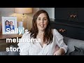 Sally's melanoma story