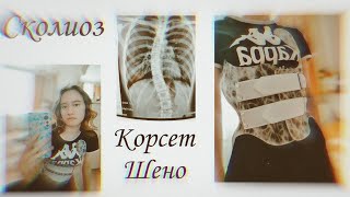 Корсет Шено | у меня сколиоз? | Моя история /⁠ᐠ⁠｡⁠ꞈ⁠｡⁠ᐟ⁠\