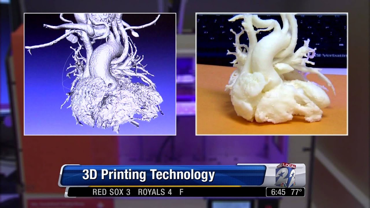 Owen Conflenti: 3D Printing Body Parts - MaxresDefault