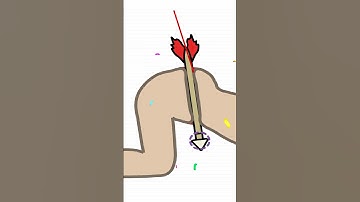 Help Me: Tricky Story - Gameplay Part 2-6 Fun Game