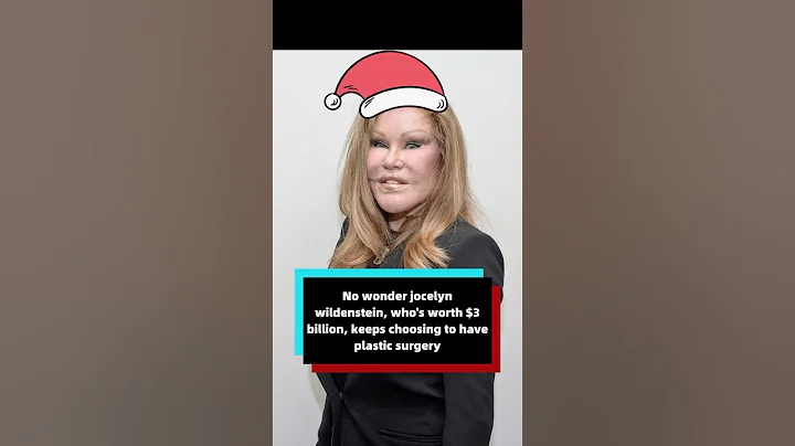 No wonder jocelyn wildenstein, who's worth $3 billion, keeps choosing to have plastic surgery.