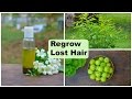 Regrow Lost Hair Naturally on Bald Spots & Forehead Fast For Men & Women | Herbal Hair Regrowth Oil