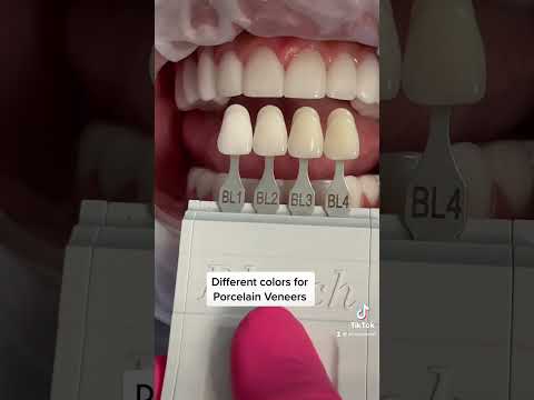 Porcelain Veneers Color Options #shorts #porcelainveneers #cosmeticdentistry #celebritysmiles #teeth