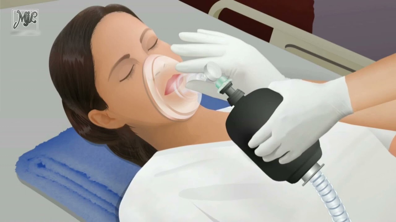 Endotracheal Tube Intubation Nasotracheal YouTube