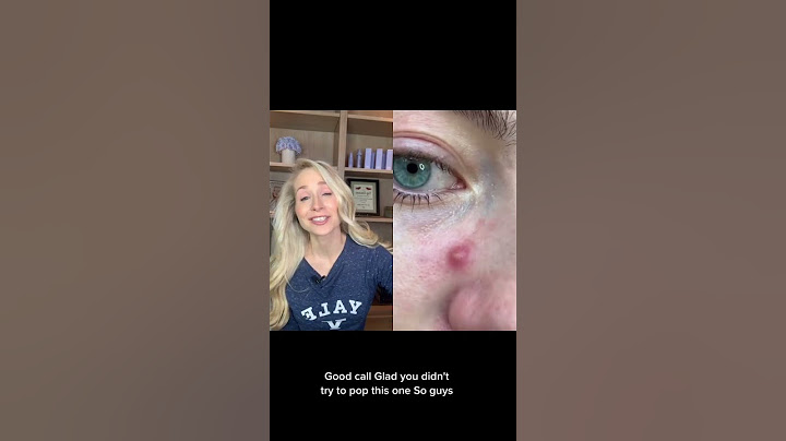 Dermatologist on Pimple Patch Removal #shorts