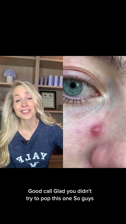 Dermatologist on Pimple Patch Removal #shorts
