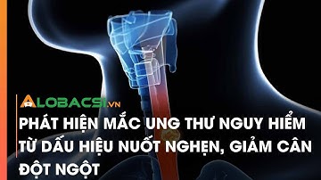 Phát hiện mắc ung thư nguy hiểm từ dấu hiệu nuốt nghẹn, giảm cân đột ngột