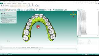 [DAD] How to plan distalization using the DAD software 