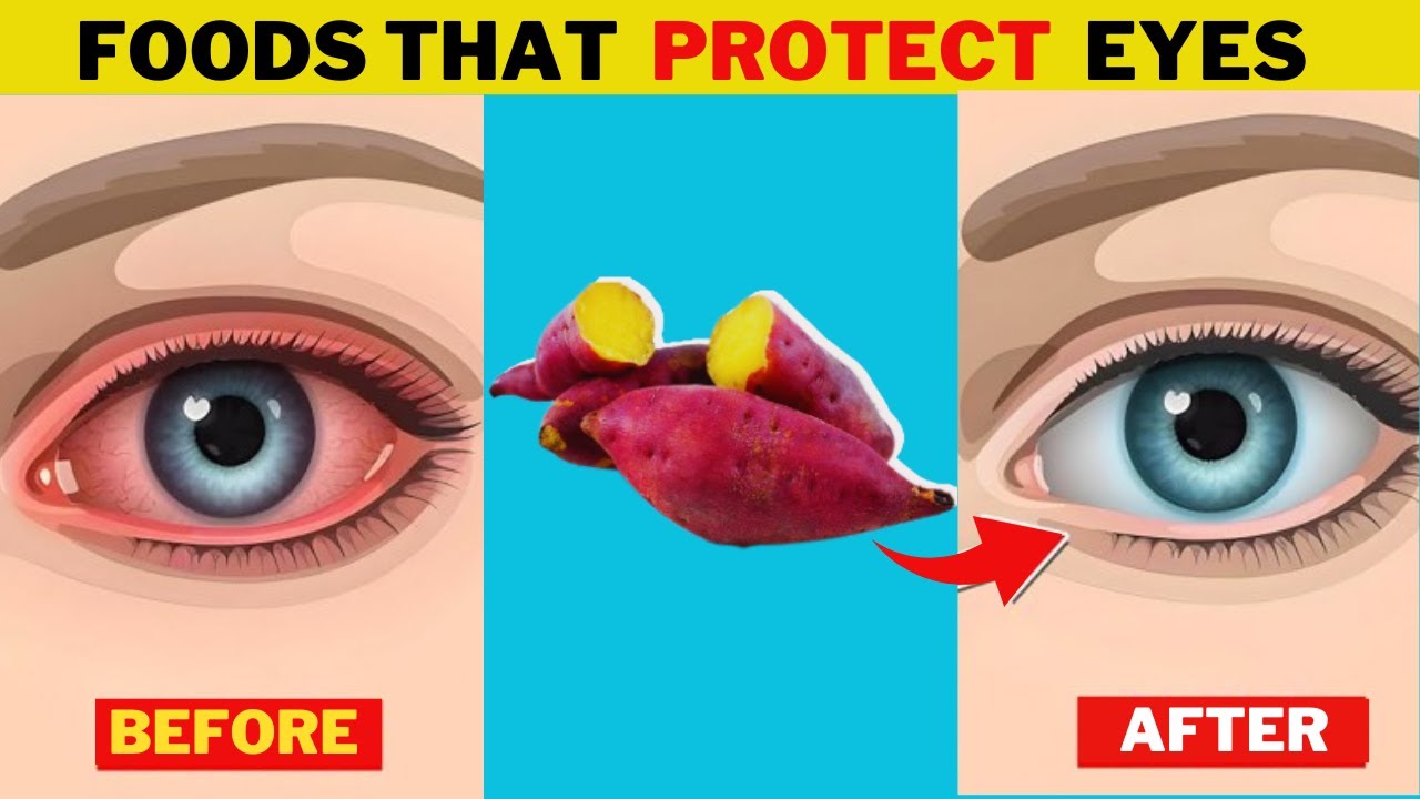11 Foods That Protect Eyes and Repair Vision