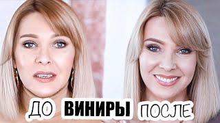 видео: УЛЫБКА МЕЧТЫ✦ВСЯ ПРАВДА О ВИНИРАХ✦МОЯ ИСТОРИЯ✦ВИНИРЫ  И ИМПЛАНТАЦИЯ ЗУБОВ✦ТАТЬЯНА РЕВА картинка: УЛЫБКА МЕЧТЫ✦ВСЯ ПРАВДА О ВИНИРАХ✦МОЯ ИСТОРИЯ✦ВИНИРЫ  И ИМПЛАНТАЦИЯ ЗУБОВ✦ТАТЬЯНА РЕВА