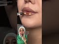 اكيد في كتير زيي اكيد في كتير زيي