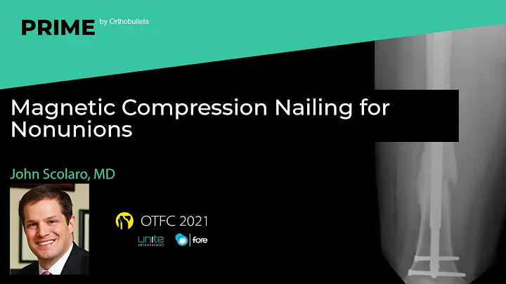Magnetic Compression Nailing for Nonunions - John Scolaro, MD