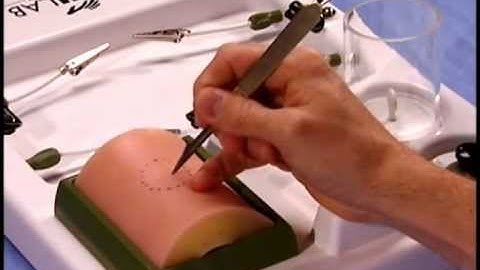 Using a #11 blade scalpel: Proper Technique