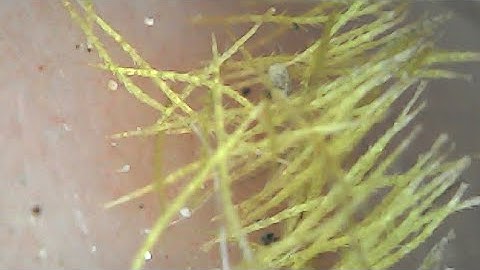 Removing Cactus Spines