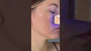 Профессиональная ультразвуковая чистка теперь у вас дома вместе с Olzori✨ #beauty #чистка
