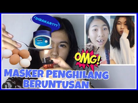 Kehebatan Vaseline Komedo Terangkat Dan Kulit Menjadi Cerah Youtube