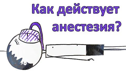 Как действует анестезия? Что такое наркоз?