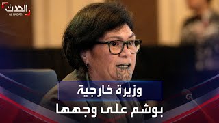 ما دلالة ومعنى الوشم المدقوق على ذقن وزيرة خارجية نيوزيلندا؟