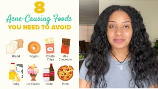 ብጉርን የሚያስከትሉ የምግብ አይነቶች // foods that can cause acne