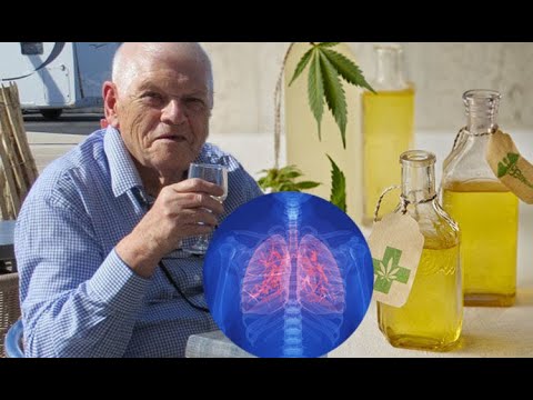 Lung cancer patient SHRUNK tumour using cannabidiol CBD oil [Q5o78N9doMwn]